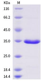 SARS 3CL Protease His-tag Protein