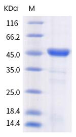 SARS-CoV-2 Envelope Protein (mutant) His-tag Protein