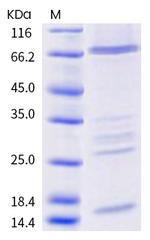 SARS-CoV-2 Helicase His-tag Protein