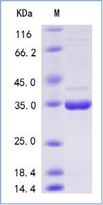 SARS-CoV-2 Methyltransferase His-tag Protein