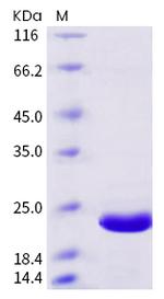 SARS-CoV-2 NSP3 His-tag Protein