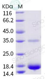 SARS-CoV-2 NSP9 His-Avi Tag Protein