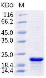 SARS-CoV-2 Nucleocapsid (aa 248-407) His-tag Protein