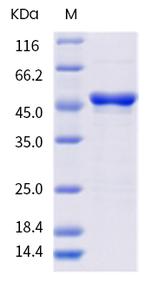 SARS-CoV-2 Nucleocapsid (D377Y) His-tag Protein
