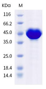 SARS-CoV-2 Nucleocapsid (P80R) His-tag Protein