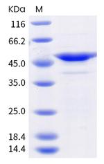 SARS-CoV-2 Nucleocapsid (T205I) His-tag Protein