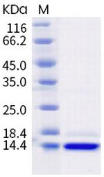 SARS-CoV-2 Nucleocapsid CTD His-tag Protein