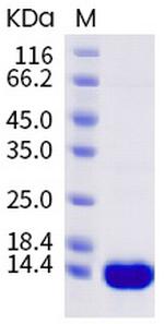 SARS-CoV-2 Nucleocapsid NTD His-tag Protein