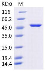 SARS-CoV-2 Nucleocapsid (mutant) His-tag Protein