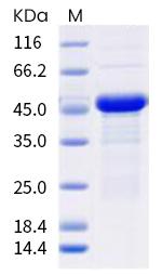 SARS-CoV-2 Nucleocapsid (I292T) His-tag Protein