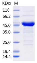 SARS-CoV-2 Nucleocapsid (S194L) His-tag Protein