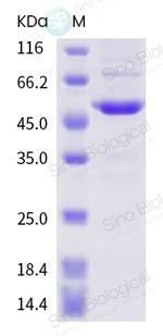 SARS-CoV-2 Nucleocapsid His-Avi Tag Protein