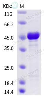 SARS-CoV-2 Nucleocapsid His-tag Protein