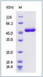 SARS-CoV-2 Nucleocapsid His-tag Protein