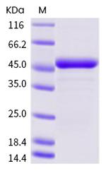 SARS-CoV-2 Nucleocapsid His-tag Protein