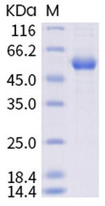 SARS-CoV-2 Spike Protein (RBD) (E484K) Fc Chimera Protein