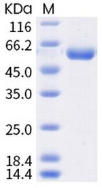 SARS-CoV-2 Spike Protein (RBD) (K417N) Fc Chimera Protein