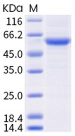 SARS-CoV-2 Spike Protein (RBD) (B.1.351) Fc Chimera Protein