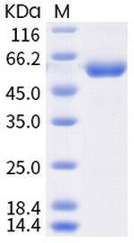 SARS-CoV-2 Spike Protein (RBD) (K417T) Fc Chimera Protein