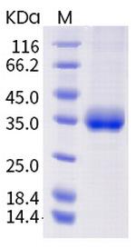 SARS-CoV-2 Spike Protein (RBD) (mutant) His-tag Protein