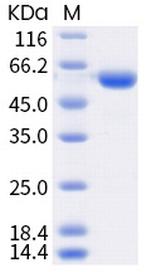 SARS-CoV-2 Spike Protein (RBD) (P.1) Fc Chimera Protein