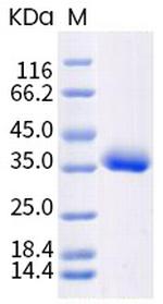 SARS-CoV-2 Spike Protein (RBD) (B.1.617) His-tag Protein