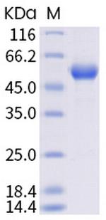 SARS-CoV-2 Spike Protein (RBD) (N501Y) Fc Chimera Protein