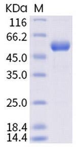 SARS-CoV-2 Spike Protein (RBD) (Y453F) Fc-tag Protein
