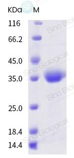 SARS-CoV-2 Spike Protein (RBD) Protein