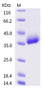 SARS-CoV-2 Spike Protein (RBD) (A344S) His-tag Protein
