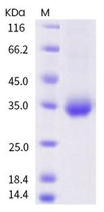 SARS-CoV-2 Spike Protein (RBD) (A348S) His-tag Protein