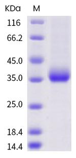 SARS-CoV-2 Spike Protein (RBD) (A352S) His-tag Protein
