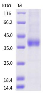 SARS-CoV-2 Spike Protein (RBD) (A372T) His-tag Protein