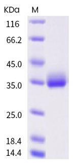 SARS-CoV-2 Spike Protein (RBD) (A520S) His-tag Protein