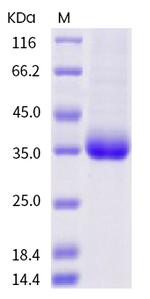 SARS-CoV-2 Spike Protein (RBD) (A520V) His-tag Protein