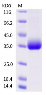 SARS-CoV-2 Spike Protein (RBD) (A522S) His-tag Protein
