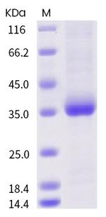 SARS-CoV-2 Spike Protein (RBD) (mutant) His-tag Protein