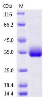 SARS-CoV-2 Spike Protein (RBD) (E471Q) His-tag Protein
