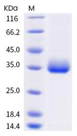 SARS-CoV-2 Spike Protein (RBD) (E484K) His-tag Protein