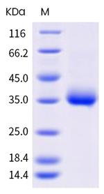 SARS-CoV-2 Spike Protein (RBD) (E484Q) His-tag Protein