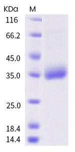 SARS-CoV-2 Spike Protein (RBD) (F338L) His-tag Protein