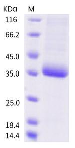 SARS-CoV-2 Spike Protein (RBD) (F377L) His-tag Protein