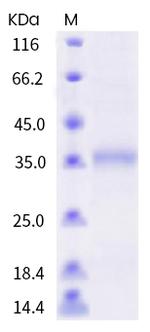 SARS-CoV-2 Spike Protein (RBD) (F456E) His-tag Protein