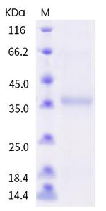 SARS-CoV-2 Spike Protein (RBD) (F456L) His-tag Protein