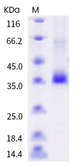 SARS-CoV-2 Spike Protein (RBD) (F486S) His-tag Protein