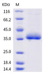 SARS-CoV-2 Spike Protein (RBD) (F490L) His-tag Protein