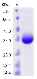 SARS-CoV-2 Spike Protein (RBD) (G446S) His-tag Protein