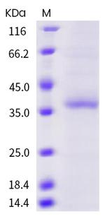 SARS-CoV-2 Spike Protein (RBD) (G446V) His-tag Protein