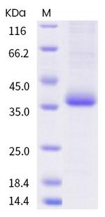 SARS-CoV-2 Spike Protein (RBD) (G482S) His-tag Protein