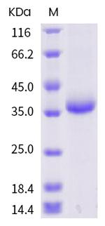 SARS-CoV-2 Spike Protein (RBD) (G485S) His-tag Protein